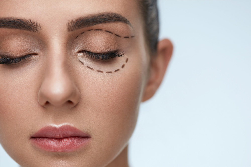blefaroplastia-cirugia-be-fabulous-madrid-centro-medico-estetico1